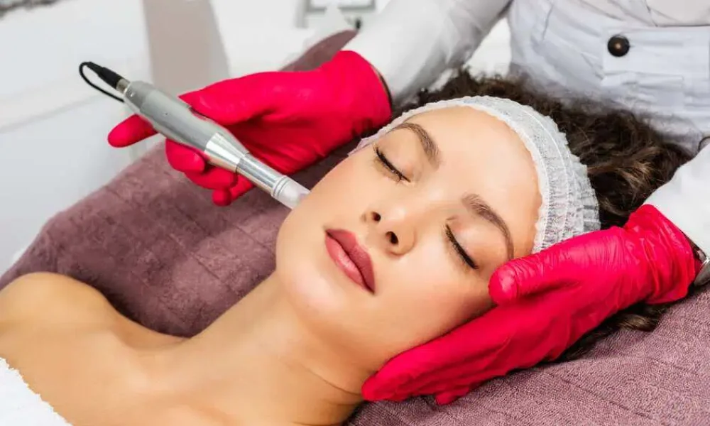Microneedling in Plainview, NY by KKD MANAGEMENT NY LLC, DBA SKYNN DEEP